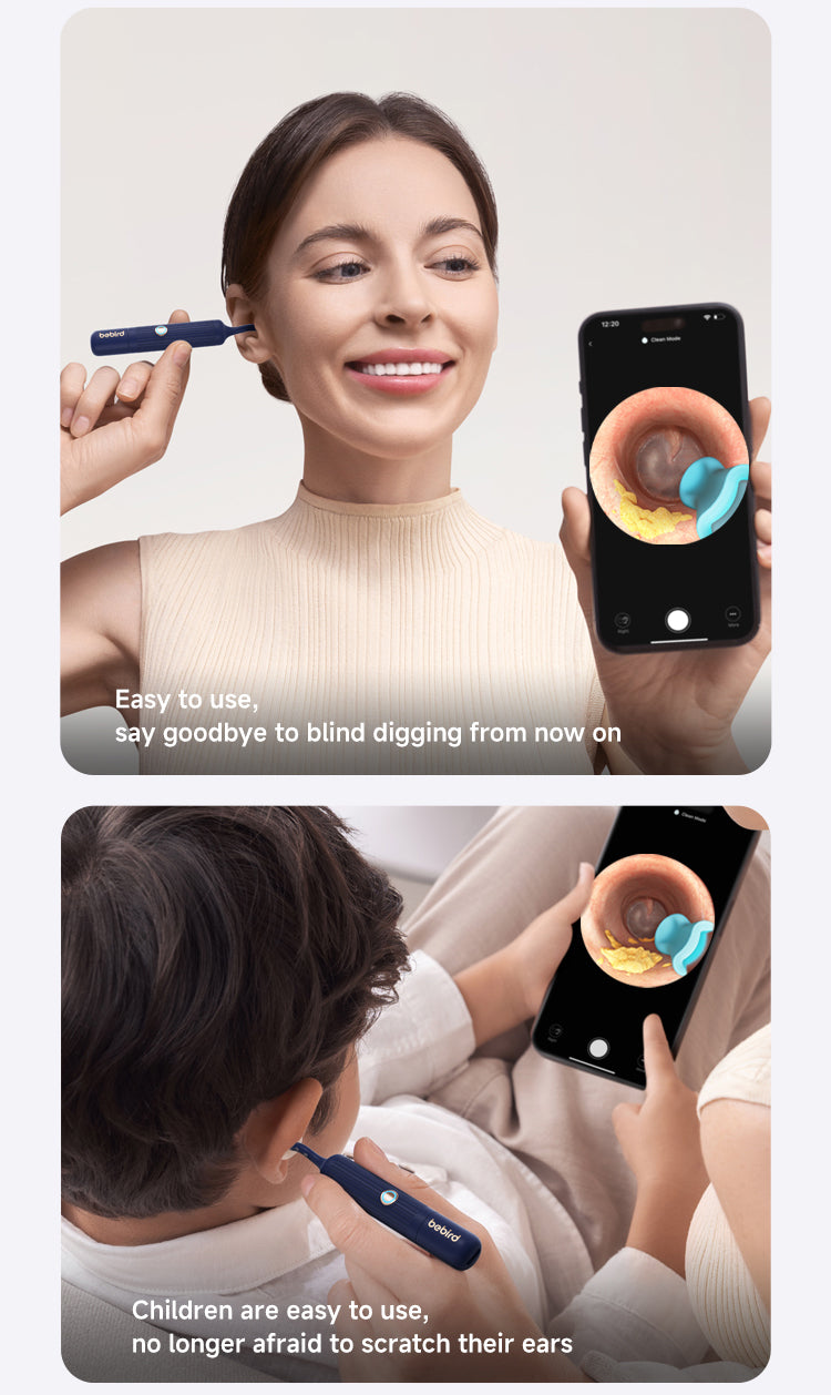 Bebird EarSight Plus Ear Cleaning Wax Removal Tool Kit With Camera